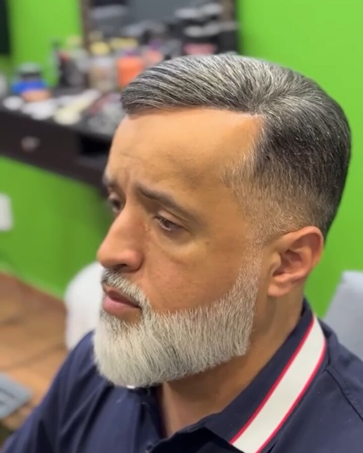 Depois — cabelo natural com prótese