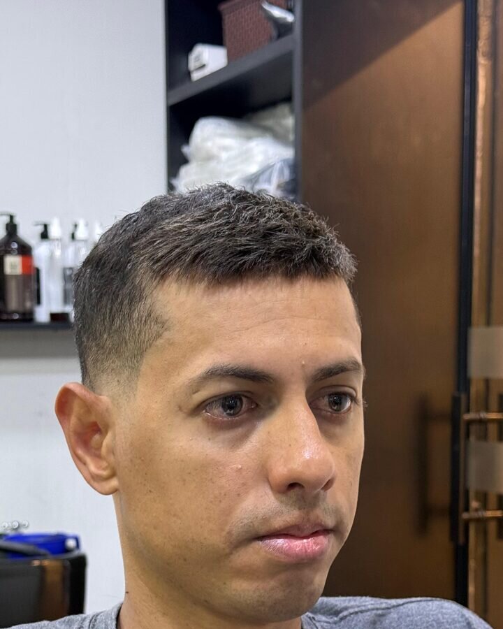 Depois — cabelo natural com prótese