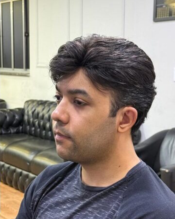 Depois — cabelo natural com prótese